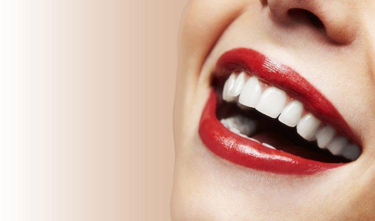 Dentes bonitos, rosto em hamornia: um sorriso perfeito transmite uma aparência jovial, feliz e radiante!