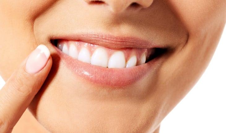 Boca de mulher com lábios e dentes aparecendo