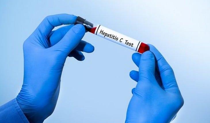 tratamento da hepatite C