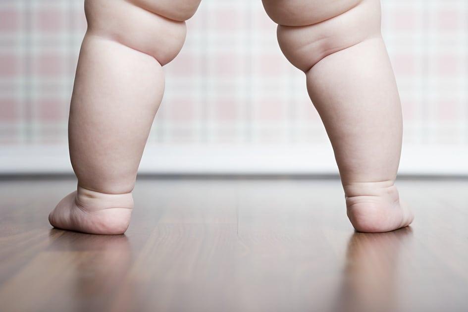 Mitos e verdades sobre a obesidade infantil: crianças obesas se tornam adultos obesos?
