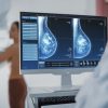Sociedade médica defende que mamografia seja realizada anualmente a partir dos 40 anos