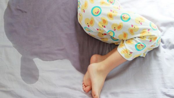 Entenda como é possível identificar e tratar a apneia obstrutiva do sono