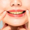Saiba quais alimentos podem deixar os seus dentes amarelos