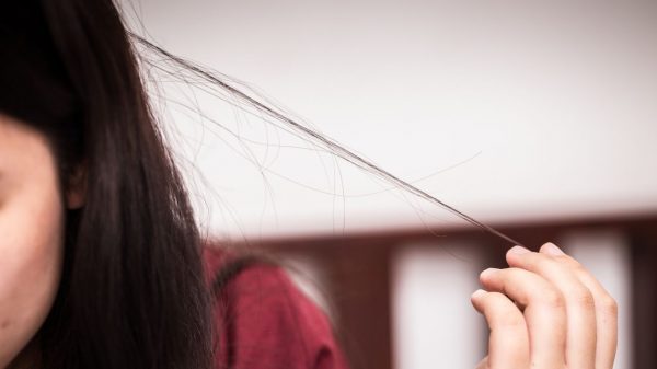 A tricotilomania é o impulso de arrancar os cabelos e pelos do corpo