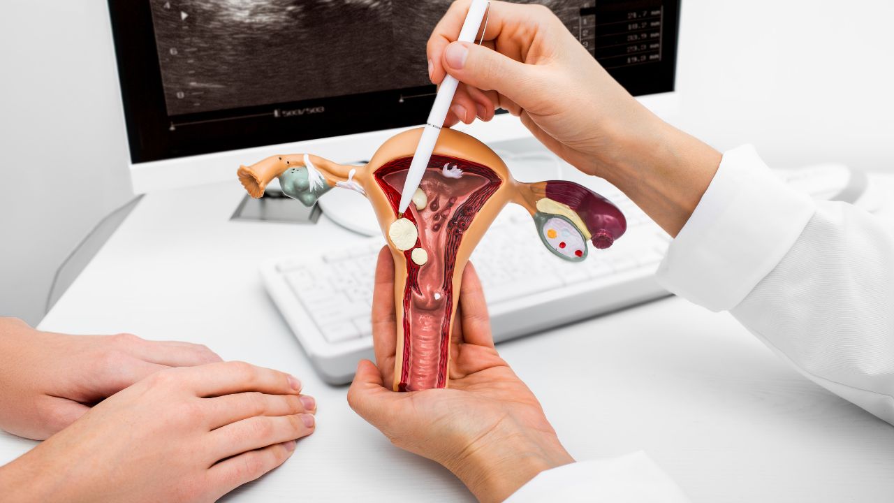Mioma uterino: o que é, causas, sintomas e como tratar a condição