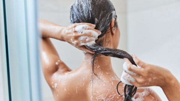 Quem tem caspa pode lavar o cabelo todos os dias? Médica responde