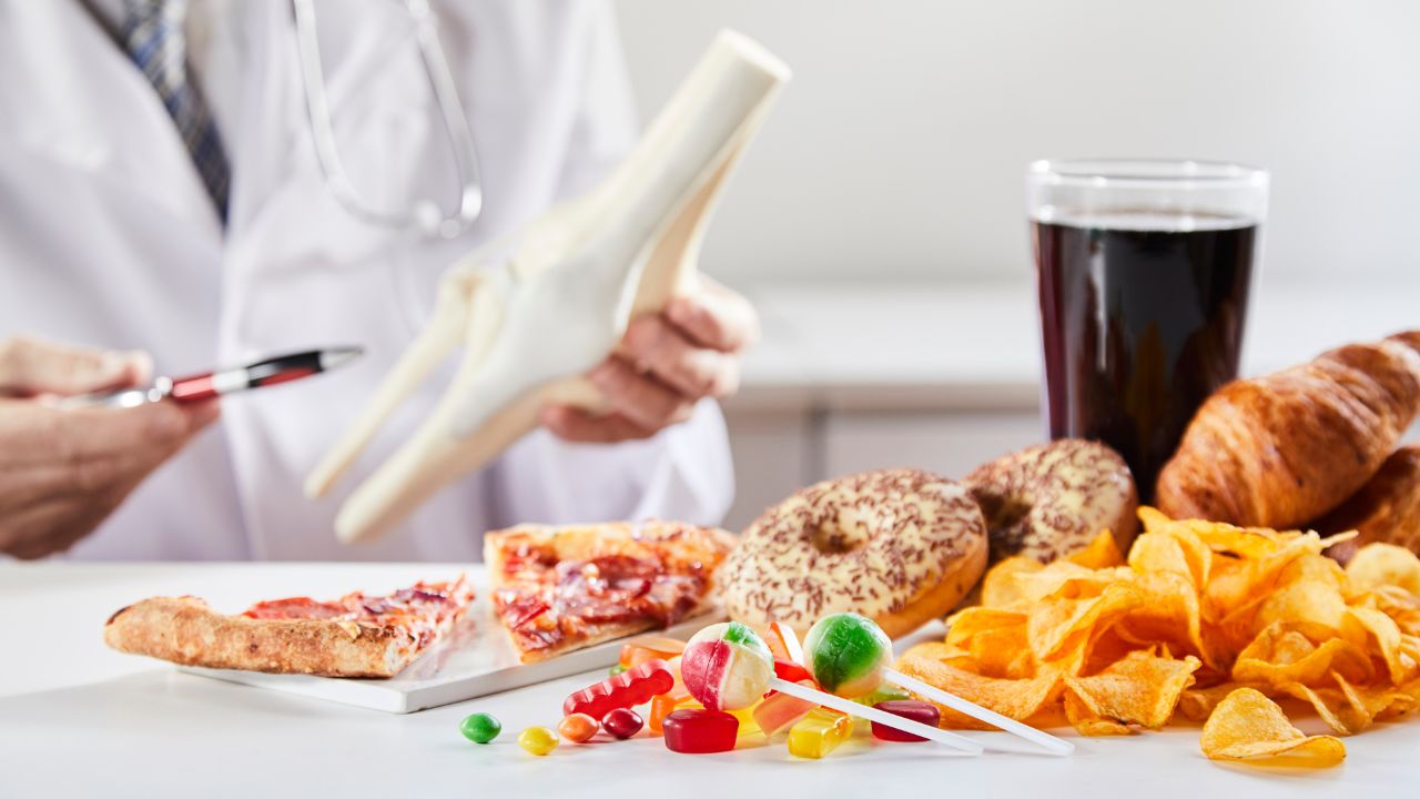 Falta de cálcio: veja alimentos que fazem mal para os ossos