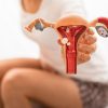Segundo ginecologista, tratamento da endometriose pode incluir medicamentos e cirurgia para remoção dos focos da doença