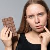 Chocolate dá espinha ou é mito? Descubra