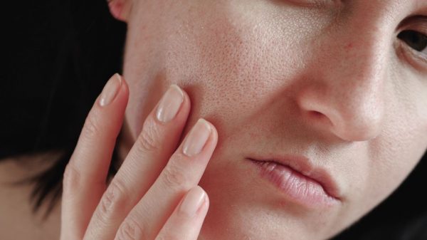 Aprenda como esconder os poros dilatados com maquiagem de maneira prática!